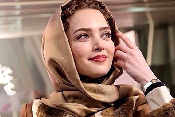 رونمایی بهنوش طباطبایی از چهره بعد از جراحی پلاستیکش عقل از سر همه پروند | عمرا اگر بهنوش طباطبایی رو تو این عکس بشناسید