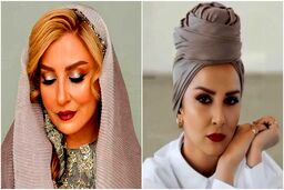 رونمایی مرجانه گلچین از چهره بعد از بوتاکسش | خانم با این حرکت 20 سال جوون شد