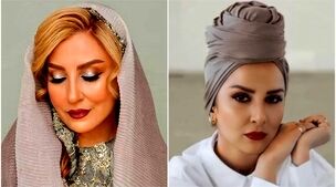 رونمایی مرجانه گلچین از چهره بعد از بوتاکسش | خانم با این حرکت 20 سال جوون شد