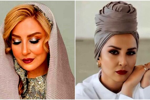 رونمایی مرجانه گلچین از چهره بعد از بوتاکسش | خانم با این حرکت 20 سال جوون شد