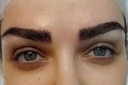 سلامت جسمی | پاکسازی موهای زائد با باقالی