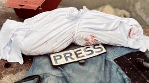 ببینید / تصویر دردناک از بقایای پیکر یک خبرنگار پس از شهادت