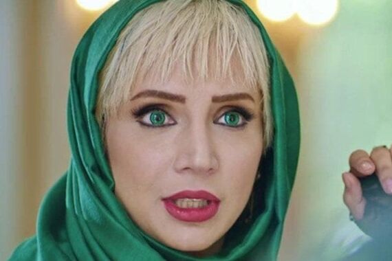 شبنم قلی خانی ام بلاخره رفت زیر تیغ جراحی | رونمایی شبنم قلی خانی از چهره جدیدش بعد از عمل بینی 