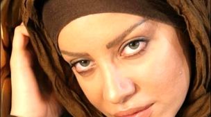 تزریق ژل لب باعث بیکاری خانم بازیگر شد + عکس