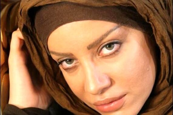 تزریق ژل لب باعث بیکاری خانم بازیگر شد + عکس