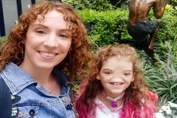 دختر بلوند بدون دماغ