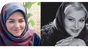 تغییر چهره 180درجه اکرم محمدی بازیگر سریال پدرسالار+عکس